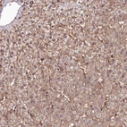Anti-ANO6 Antibody