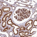 Immunohistochemical staining of human kidney shows strong membranous positivity in cells in glomeruli.