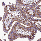Immunohistochemical staining of human placenta shows moderate membranous positivity in trophoblastic cells.