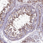 Immunohistochemical staining of human testis shows moderate membranous positivity in cells in seminiferous ducts.