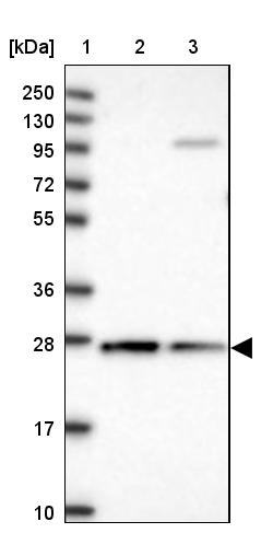 Anti-CYB5R2 Antibody