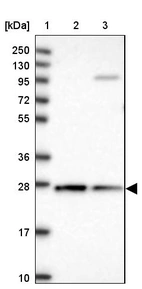 Anti-CYB5R2 Antibody