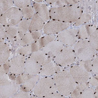 Anti-WBP4 Antibody