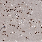 Immunohistochemical staining of human cerebral cortex shows strong nuclear positivity in neuronal cells.