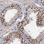 Immunohistochemical staining of human testis shows strong nuclear positivity in cells in seminiferous ducts.