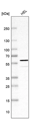 Western blot analysis in human cell line HEL.