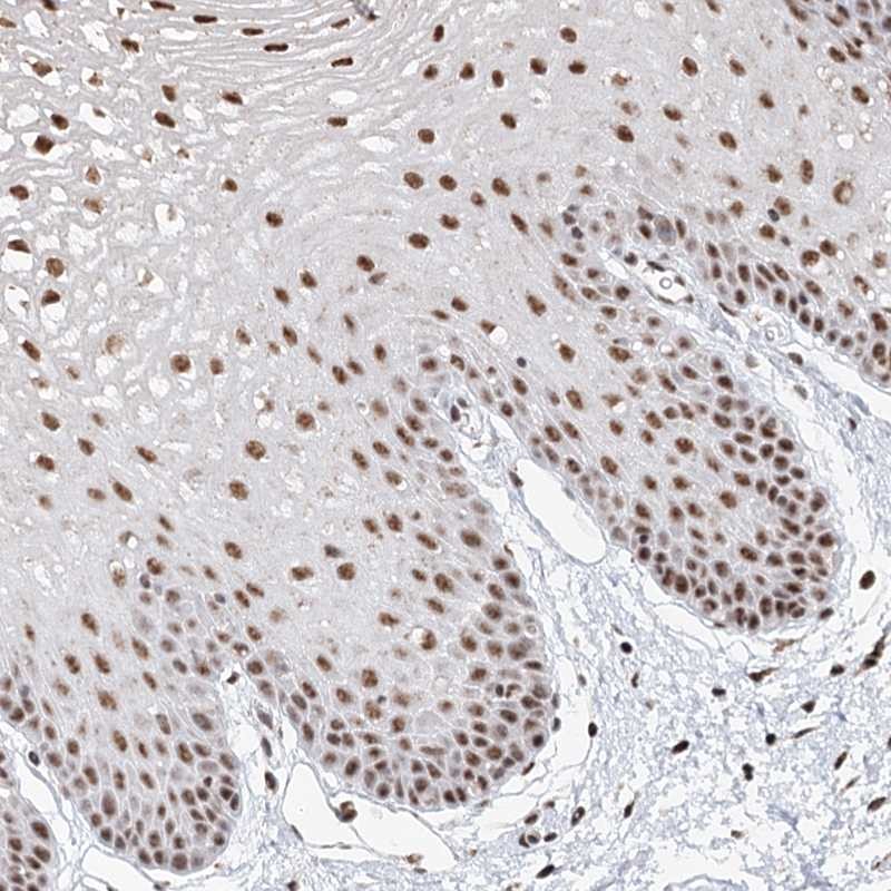 Anti-GPALPP1 Antibody