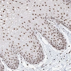 Anti-GPALPP1 Antibody