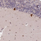 Anti-N4BP2L1 Antibody