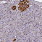 Immunohistochemical staining of human Pancreas shows strong granular cytoplasmic positivity in islets of Langerhans.