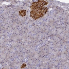 Immunohistochemical staining of human Pancreas shows strong granular cytoplasmic positivity in islets of Langerhans.