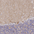 Immunohistochemical staining of human Cerebellum shows weak granular cytoplasmic positivity in Purkinje cells.