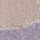 Immunohistochemical staining of human Cerebellum shows weak granular cytoplasmic positivity in Purkinje cells.