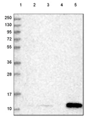 Lane 1: Marker [kDa] 250, 130, 95, 72, 55, 36, 28, 17, 10_br/_Lane 2: Human cell line RT-4_br/_Lane 3: Human cell line U-251 MG_br/_Lane 4: Human plasma_br/_Lane 5: Human Liver tissue