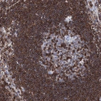 Immunohistochemical staining of human lymph node shows high expression.
