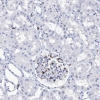 Immunohistochemical staining of human kidney shows low expression as expected.