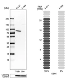Western blot analysis in human cell lines A-431 and A-549 using Anti-DEF6 antibody. Corresponding DEF6 RNA-seq data are presented for the same cell lines. Loading control: Anti-PPIB.