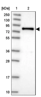 Lane 1: Marker [kDa] 250, 130, 95, 72, 55, 36, 28, 17, 10_br/_Lane 2: Human cell line RT-4