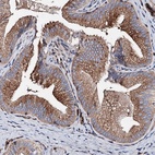 Anti-WDR11 Antibody