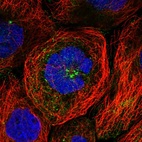 Immunofluorescent staining of human cell line A-431 shows localization to cytosol.