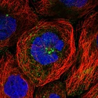 Immunofluorescent staining of human cell line A-431 shows localization to cytosol.