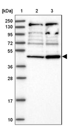 Lane 1: Marker [kDa] 250, 130, 95, 72, 55, 36, 28, 17, 10_br/_Lane 2: Human cell line RT-4_br/_Lane 3: Human cell line U-251MG sp