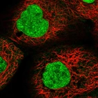 Immunofluorescent staining of human cell line A-431 shows localization to nucleoplasm.
