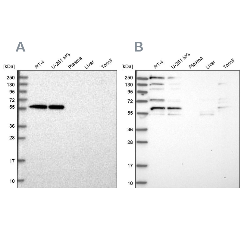 Anti-SAAL1 Antibody