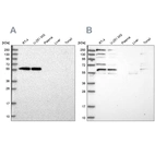 Anti-SAAL1 Antibody