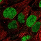 Immunofluorescent staining of human cell line CACO-2 shows localization to nucleoplasm.