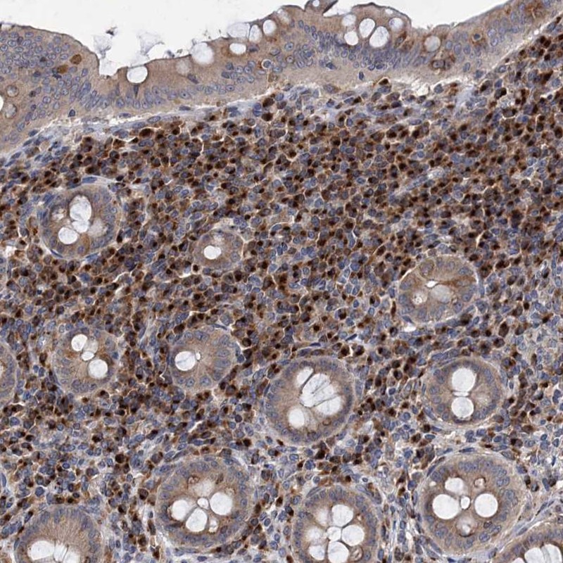 Anti-SAAL1 Antibody