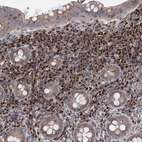 Anti-SAAL1 Antibody