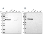 Western blot analysis using Anti-SAAL1 antibody HPA039004 (A) shows similar pattern to independent antibody HPA039003 (B).