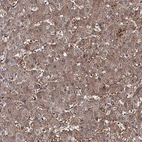 Immunohistochemical staining of human liver shows moderate granular cytoplasmic positivity in hepatocytes.