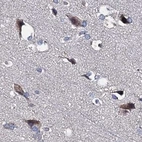 Immunohistochemical staining of human cerebral cortex using Anti-CLPB antibody HPA039005.