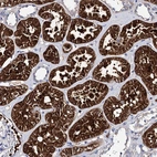 Immunohistochemical staining of human kidney shows very strong granular cytoplasmic positivity in cells in tubules.