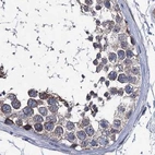 Immunohistochemical staining of human testis using Anti-CLPB antibody HPA039005.