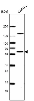 Western blot analysis in human cell line CACO-2.
