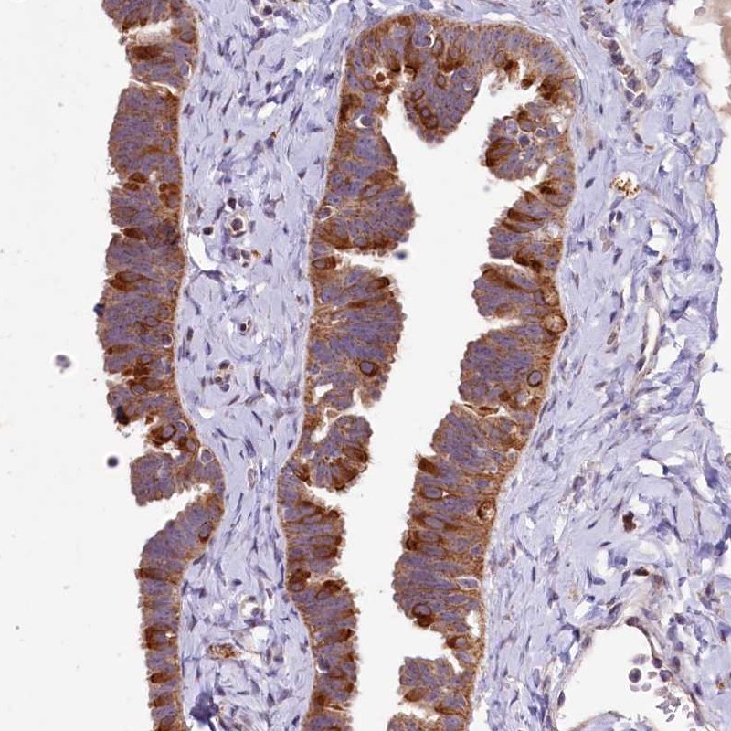 Anti-DYNC2H1 Antibody