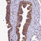 Anti-DYNC2H1 Antibody