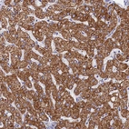 Anti-MMAB Antibody