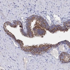 Immunohistochemical staining of human prostate shows strong granular cytoplasmic positivity in glandular cells.