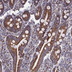 Immunohistochemical staining of human duodenum shows strong granular cytoplasmic positivity in glandular cells.