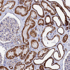 Immunohistochemical staining of human kidney shows strong granular cytoplasmic positivity in cells in tubules.
