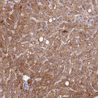 Immunohistochemical staining of human liver shows strong cytoplasmic positivity in hepatocytes.