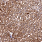 Immunohistochemical staining of human liver shows strong cytoplasmic positivity in hepatocytes.