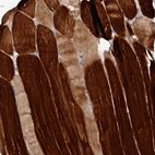 Immunohistochemical staining of human skeletal muscle shows strong cytoplasmic positivity in myocytes.