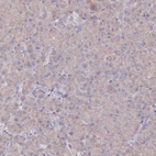 Immunohistochemical staining of human pancreas shows low positivity in exocrine glandular cells as expected.
