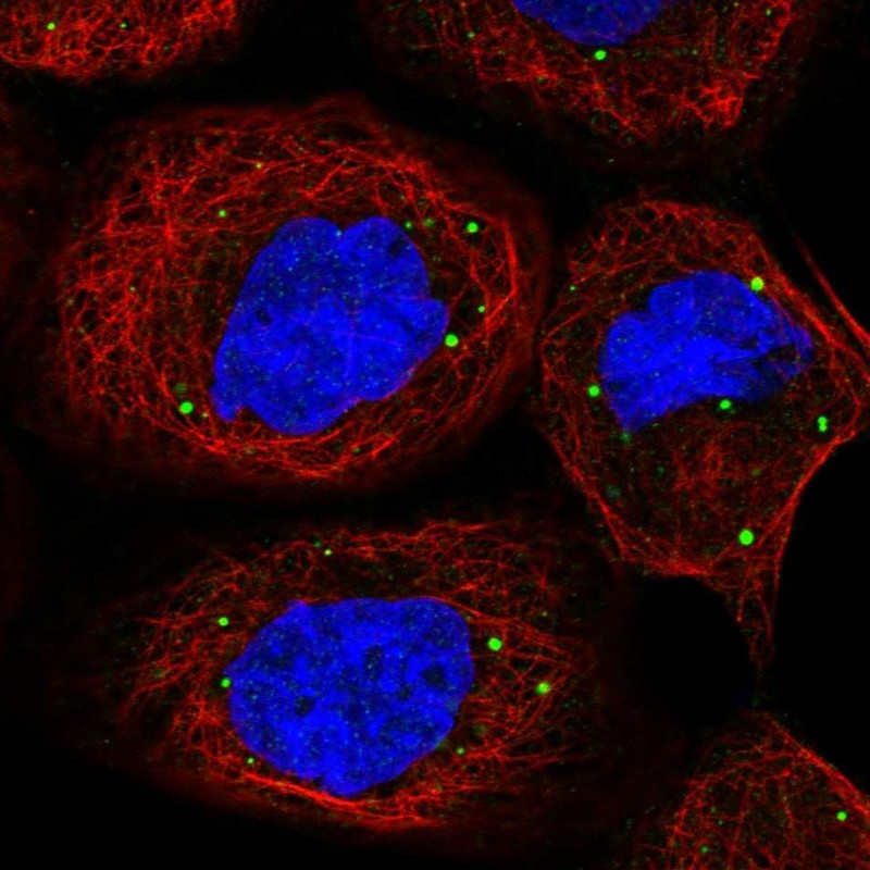 Anti-PATL1 Antibody