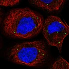 Anti-PATL1 Antibody